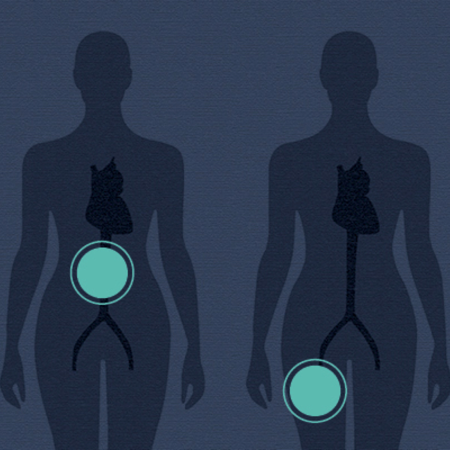 Young, fit and female? Higher chance of misdiagnosis.