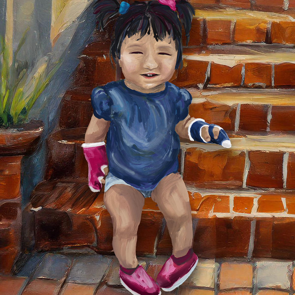 Overcoming the Odds of Prenatal Hypophosphatasia Overcoming the Odds of Prenatal Hypophosphatasia